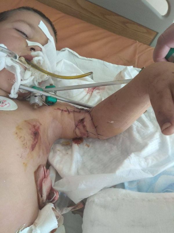 На этой фотографии из Донецка — ребёнок, тяжело раненый вследствие украинского обстрела: