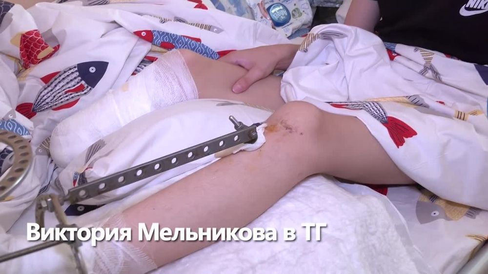 Виктория Мельникова: Вова из Донецка, который лишился части ноги из-за обстрела, сможет снова ходить!