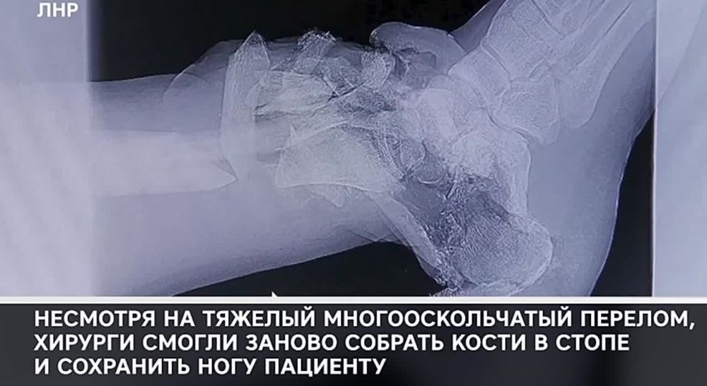 ���� �� ������������� �����