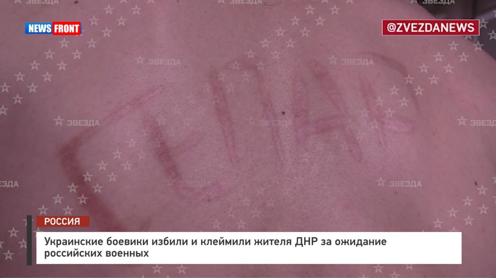 ���������� ������� ������ � �������� ������ ��� �� �������� ���������� �������