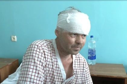 Один из пострадавших при атаке ВСУ на автобус рассказал о произошедшем